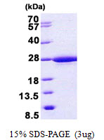 IFT22 / RABL5 Protein
