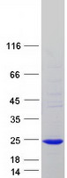 IFT22 / RABL5 Protein - Purified recombinant protein IFT22 was analyzed by SDS-PAGE gel and Coomassie Blue Staining