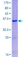IFT27 / RABL4 Protein - 12.5% SDS-PAGE of human RABL4 stained with Coomassie Blue