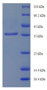 IFT27 / RABL4 Protein
