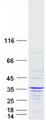 IFT43 / C14orf179 Protein - Purified recombinant protein IFT43 was analyzed by SDS-PAGE gel and Coomassie Blue Staining