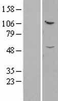 IFT52 Protein - Western validation with an anti-DDK antibody * L: Control HEK293 lysate R: Over-expression lysate