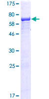 IFT52 Protein - 12.5% SDS-PAGE of human IFT52 stained with Coomassie Blue