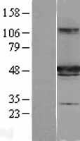 IFT57 / HIPPI Protein - Western validation with an anti-DDK antibody * L: Control HEK293 lysate R: Over-expression lysate