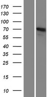 IFT74 / CCDC2 Protein - Western validation with an anti-DDK antibody * L: Control HEK293 lysate R: Over-expression lysate
