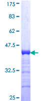 IFT74 / CCDC2 Protein - 12.5% SDS-PAGE Stained with Coomassie Blue.