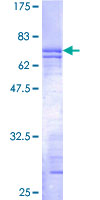 IGBP1 Protein - 12.5% SDS-PAGE of human IGBP1 stained with Coomassie Blue