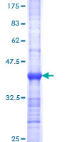 IGBP1 Protein - 12.5% SDS-PAGE Stained with Coomassie Blue.