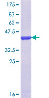IGDCC3 Protein - 12.5% SDS-PAGE Stained with Coomassie Blue.