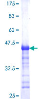 IGDCC4 / NOPE Protein - 12.5% SDS-PAGE Stained with Coomassie Blue.