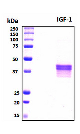 IGF1 Protein - SDS-PAGE under reducing conditions and visualized by Coomassie blue staining