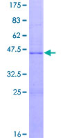 IGF1 Protein - 12.5% SDS-PAGE of human IGF1 stained with Coomassie Blue