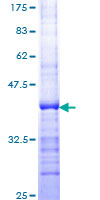IGF1 Protein - 12.5% SDS-PAGE Stained with Coomassie Blue.