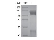 IGF1R / IGF1 Receptor Protein - Recombinant Human IGF-I R/IGF1R (C-6His)
