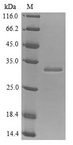 IGF1R / IGF1 Receptor Protein - (Tris-Glycine gel) Discontinuous SDS-PAGE (reduced) with 5% enrichment gel and 15% separation gel.