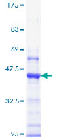 IGF1R / IGF1 Receptor Protein - 12.5% SDS-PAGE Stained with Coomassie Blue.
