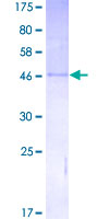 IGF2 Protein - 12.5% SDS-PAGE of human IGF2 stained with Coomassie Blue