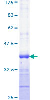 IGF2 Protein - 12.5% SDS-PAGE Stained with Coomassie Blue.