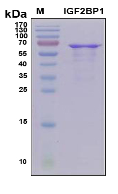IGF2BP2 Protein - SDS-PAGE under reducing conditions and visualized by Coomassie blue staining