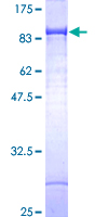 IGF2BP2 Protein - 12.5% SDS-PAGE of human IMP-2 stained with Coomassie Blue