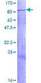 IGF2BP2 Protein - 12.5% SDS-PAGE of human IGF2BP2 stained with Coomassie Blue