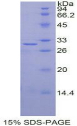IGF2BP2 Protein - Recombinant Insulin Like Growth Factor 2 mRNA Binding Protein 2 By SDS-PAGE