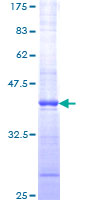 IGF2R / CD222 Protein - 12.5% SDS-PAGE Stained with Coomassie Blue.