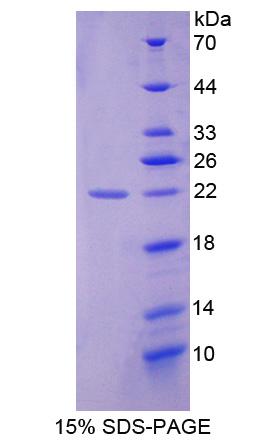 IGF2R / CD222 Protein - Recombinant Mannose-6-Phosphate Receptor By SDS-PAGE