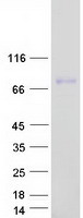 IGFALS / ALS Protein - Purified recombinant protein IGFALS was analyzed by SDS-PAGE gel and Coomassie Blue Staining