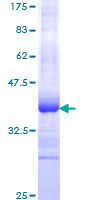IGFBP1 Protein - 12.5% SDS-PAGE Stained with Coomassie Blue.