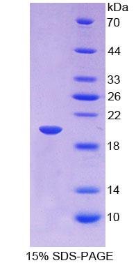 IGFBP2 / IGF-BP53 Protein - Recombinant  Insulin Like Growth Factor Binding Protein 2 By SDS-PAGE