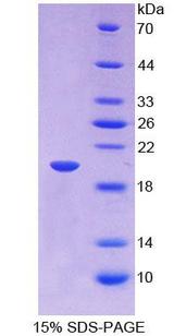 IGFBP2 / IGF-BP53 Protein - Recombinant  Insulin Like Growth Factor Binding Protein 2 By SDS-PAGE