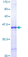 IGFBP3 Protein - 12.5% SDS-PAGE Stained with Coomassie Blue.