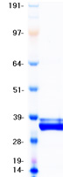 IGFBP4 Protein - Purified recombinant protein IGFBP4 was analyzed by SDS-PAGE gel and Coomassie Blue Staining