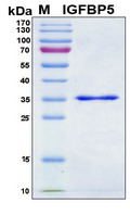 IGFBP5 Protein - SDS-PAGE under reducing conditions and visualized by Coomassie blue staining