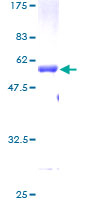 IGFBP6 Protein - 12.5% SDS-PAGE of human IGFBP6 stained with Coomassie Blue