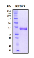 IGFBP7 / TAF Protein - SDS-PAGE under reducing conditions and visualized by Coomassie blue staining