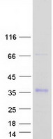 IGFBP7 / TAF Protein - Purified recombinant protein IGFBP7 was analyzed by SDS-PAGE gel and Coomassie Blue Staining