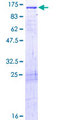 IGFN1 Protein - 12.5% SDS-PAGE of human DKFZp434B1231 stained with Coomassie Blue
