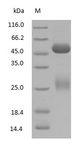 Human IgG Protein - (Tris-Glycine gel) Discontinuous SDS-PAGE (reduced) with 5% enrichment gel and 15% separation gel.
