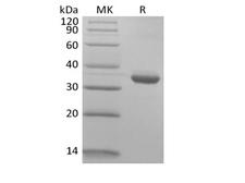 IgG1 Fc Protein - Recombinant Human IgG1 Fc Biotinylated