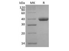 Human IgG3 Protein - Recombinant Human IgG3 Fc