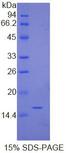 Human IgG4 Protein - Recombinant Immunoglobulin G4 By SDS-PAGE