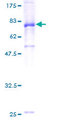 IGHA1 / IgA1 Protein - 12.5% SDS-PAGE of human IGHA1 stained with Coomassie Blue