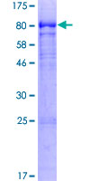 IGHD Protein - 12.5% SDS-PAGE of human IGHD stained with Coomassie Blue