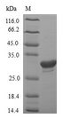 IGHG1 / IgG Protein - (Tris-Glycine gel) Discontinuous SDS-PAGE (reduced) with 5% enrichment gel and 15% separation gel.