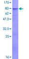 IGHG4 Protein - 12.5% SDS-PAGE of human IGHG4 stained with Coomassie Blue