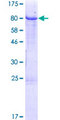 IGHM / IgM Protein - 12.5% SDS-PAGE of human IGHM stained with Coomassie Blue
