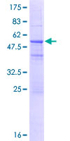 IGKV1-5 / Immunoglobulin kappa Protein - 12.5% SDS-PAGE Stained with Coomassie Blue