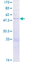 IGLL1 / CD179b Protein - 12.5% SDS-PAGE of human IGLL1 stained with Coomassie Blue